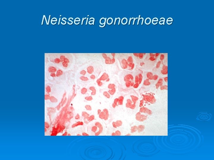 Neisseria gonorrhoeae 