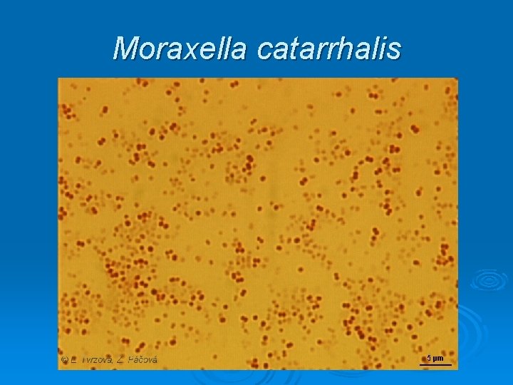 Moraxella catarrhalis 
