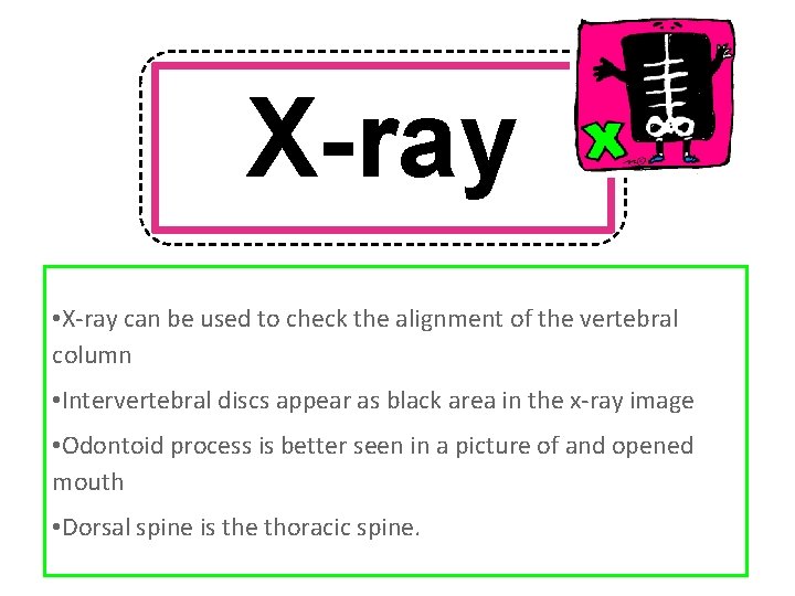 X-ray • X-ray can be used to check the alignment of the vertebral column