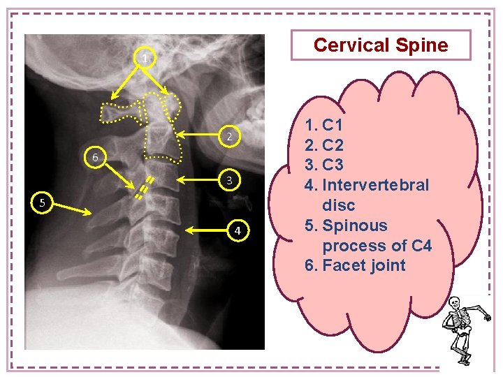 Cervical Spine 1 2 6 3 5 4 1. C 1 2. C 2