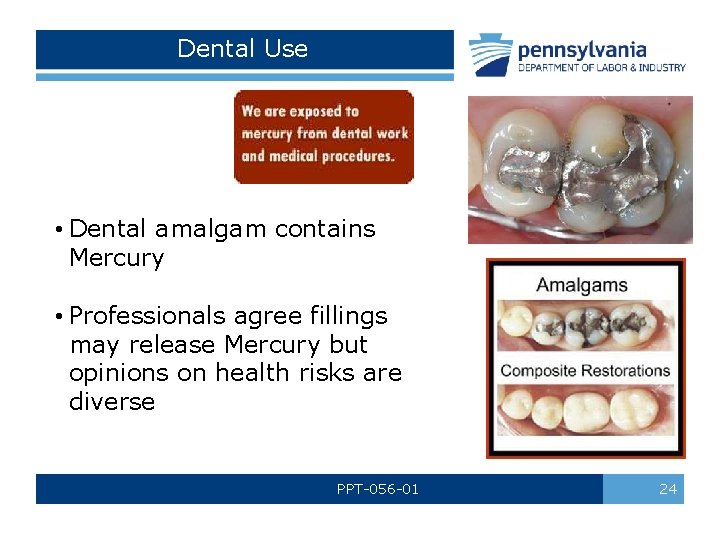 Dental Use • Dental amalgam contains Mercury • Professionals agree fillings may release Mercury