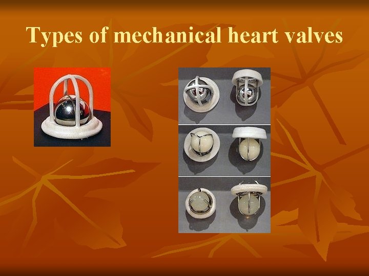 Types of mechanical heart valves 