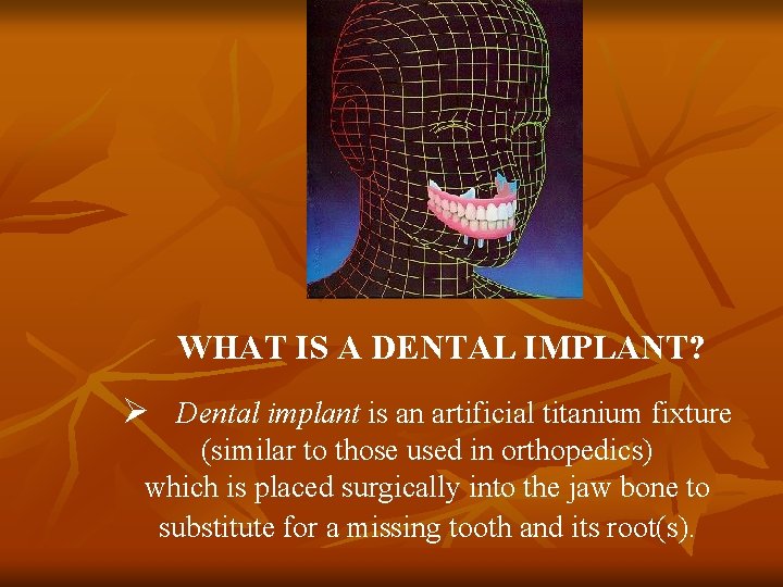 WHAT IS A DENTAL IMPLANT? Ø Dental implant is an artificial titanium fixture (similar