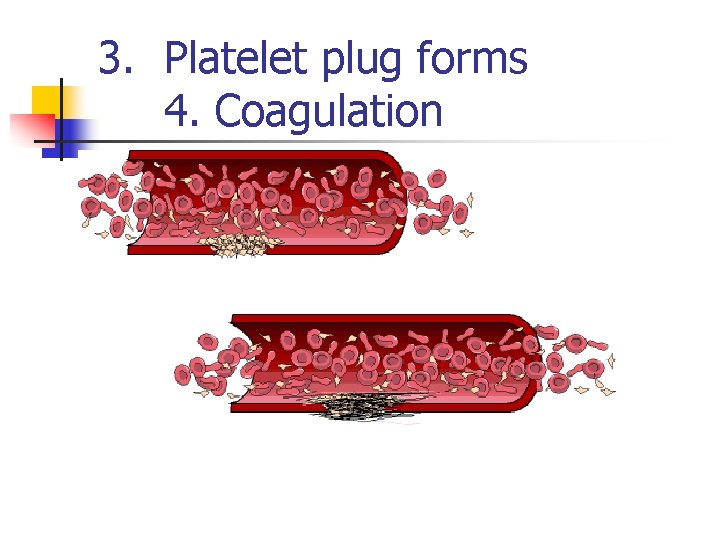 3. Platelet plug forms 4. Coagulation n n 