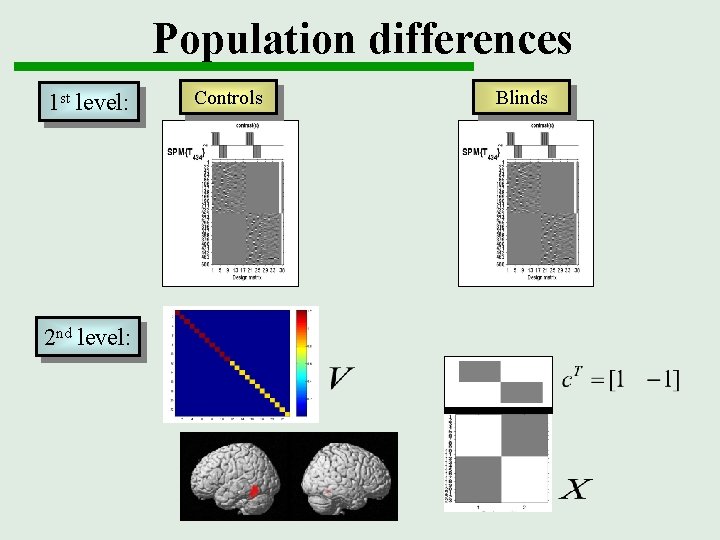 Population differences 1 st level: 2 nd level: Controls Blinds 