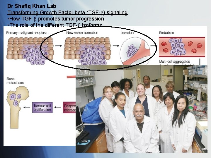 Dr Shafiq Khan Lab Transforming Growth Factor beta (TGF-b) signaling • How TGF-b promotes