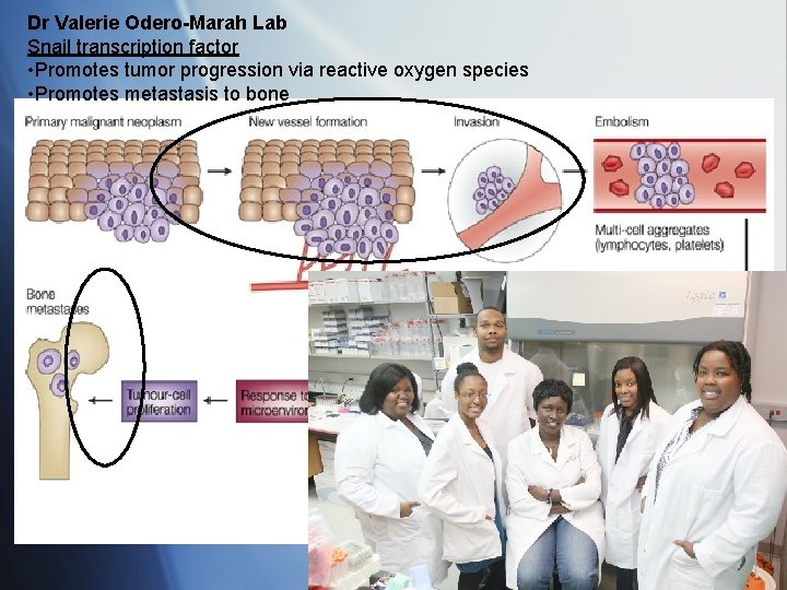 Dr Valerie Odero-Marah Lab Snail transcription factor • Promotes tumor progression via reactive oxygen