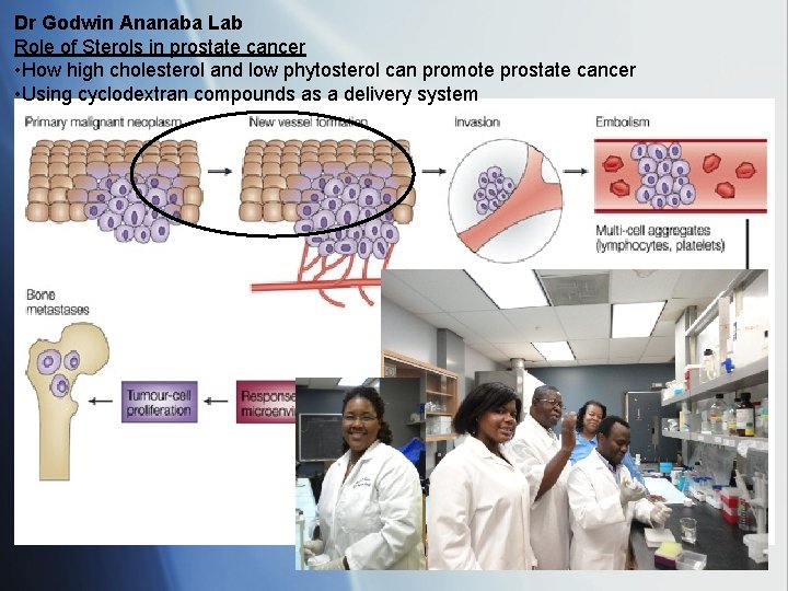 Dr Godwin Ananaba Lab Role of Sterols in prostate cancer • How high cholesterol