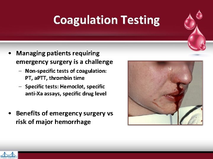 Coagulation Testing • Managing patients requiring emergency surgery is a challenge – Non-specific tests Coagulation Testing • Managing patients requiring emergency surgery is a challenge – Non-specific tests
