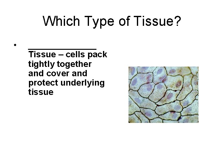 Which Type of Tissue? • _______ Tissue – cells pack tightly together and cover