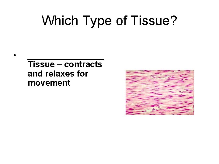 Which Type of Tissue? • ________ Tissue – contracts and relaxes for movement 