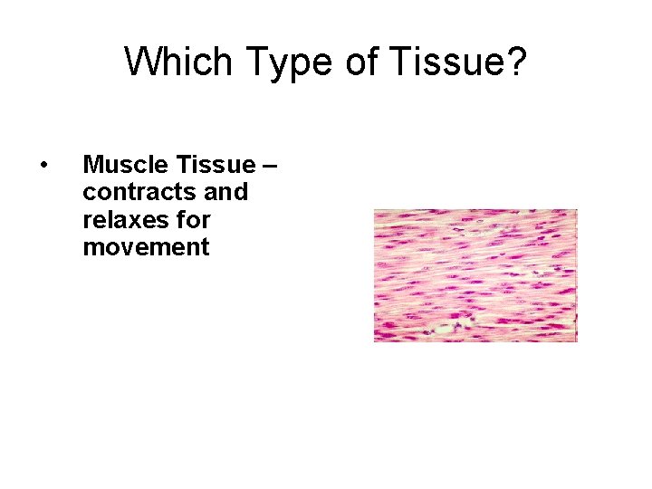 Which Type of Tissue? • Muscle Tissue – contracts and relaxes for movement 