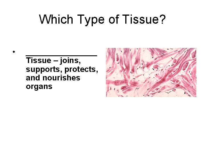 Which Type of Tissue? • ________ Tissue – joins, supports, protects, and nourishes organs