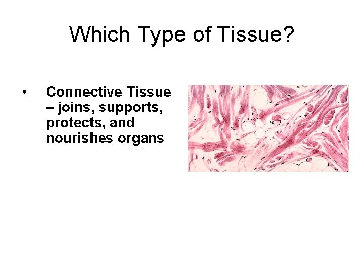 Which Type of Tissue? • Connective Tissue – joins, supports, protects, and nourishes organs