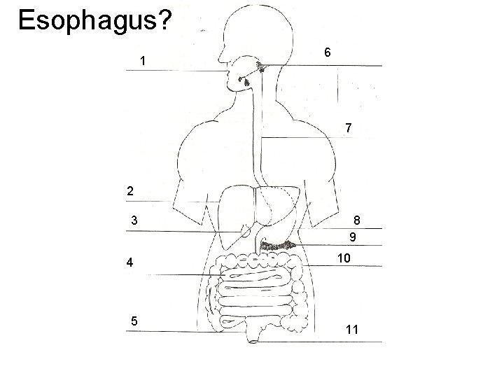 Esophagus? 1 6 7 2 3 4 5 8 9 10 11 