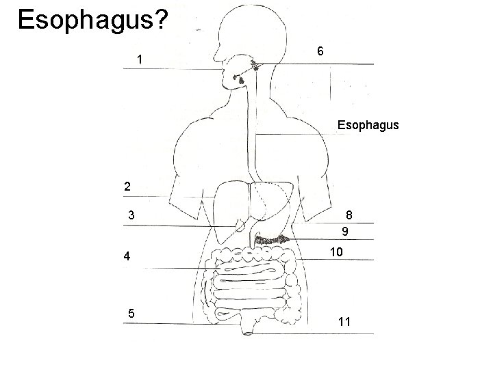 Esophagus? 1 6 Esophagus 2 3 4 5 8 9 10 11 