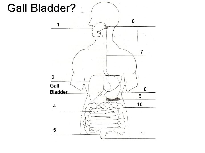 Gall Bladder? 1 6 7 2 Gall Bladder 4 5 8 9 10 11