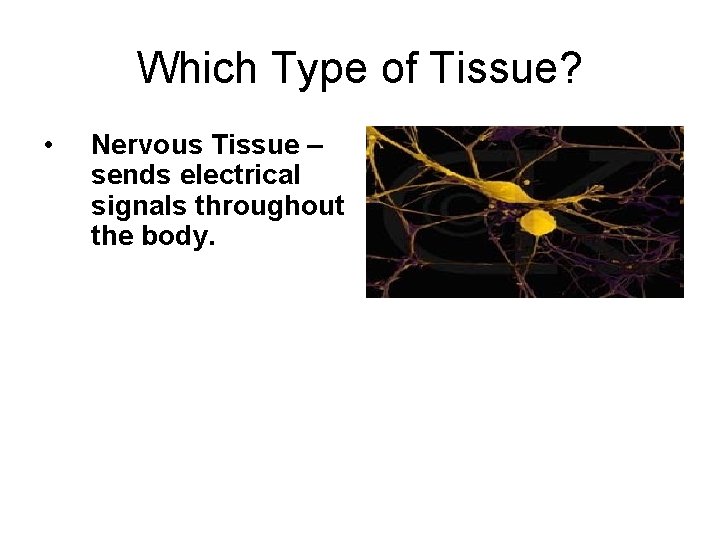 Which Type of Tissue? • Nervous Tissue – sends electrical signals throughout the body.