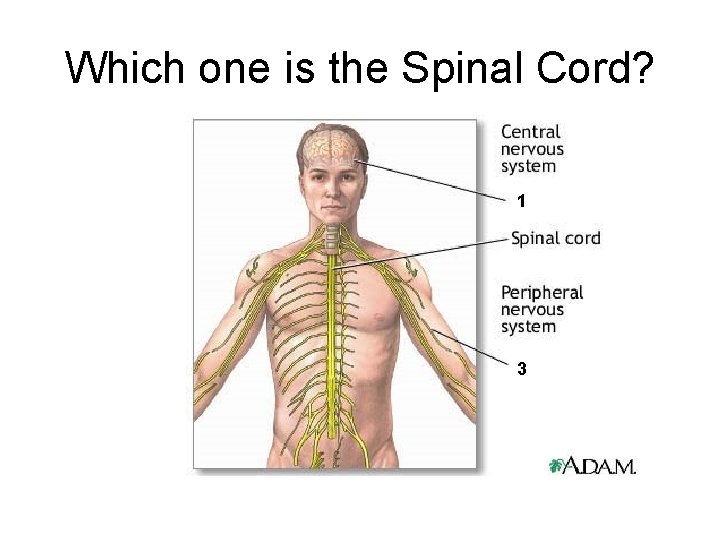 Which one is the Spinal Cord? 1 3 