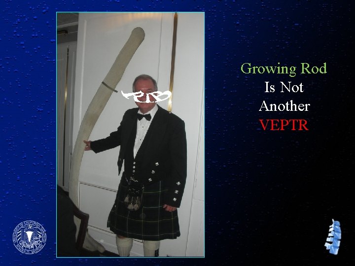 Growing Rod Is Not Another VEPTR 