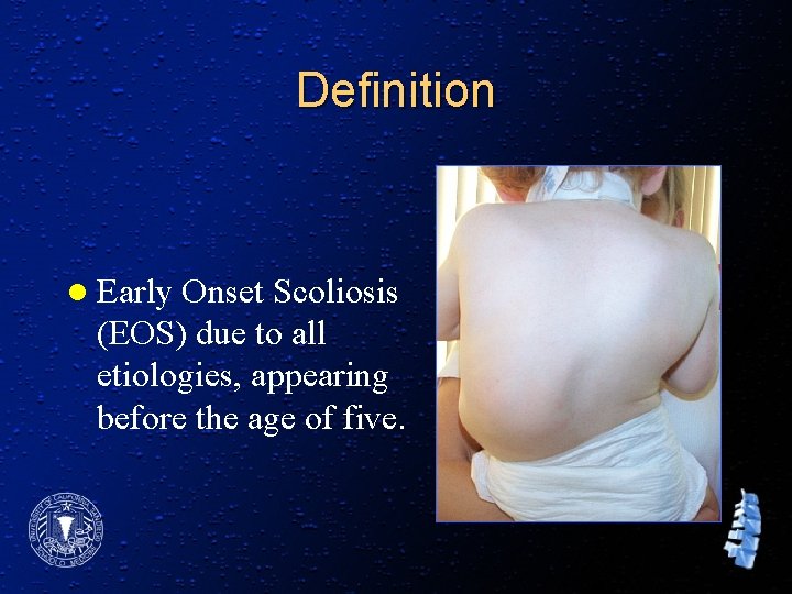 Definition l Early Onset Scoliosis (EOS) due to all etiologies, appearing before the age
