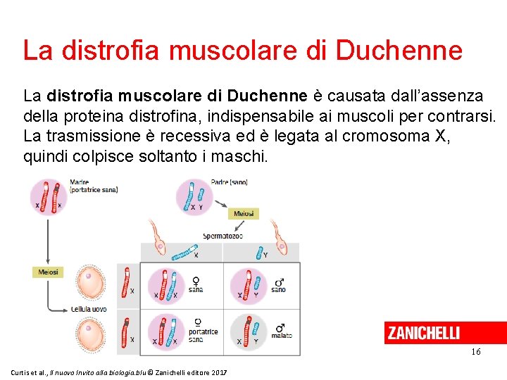 La distrofia muscolare di Duchenne è causata dall’assenza della proteina distrofina, indispensabile ai muscoli