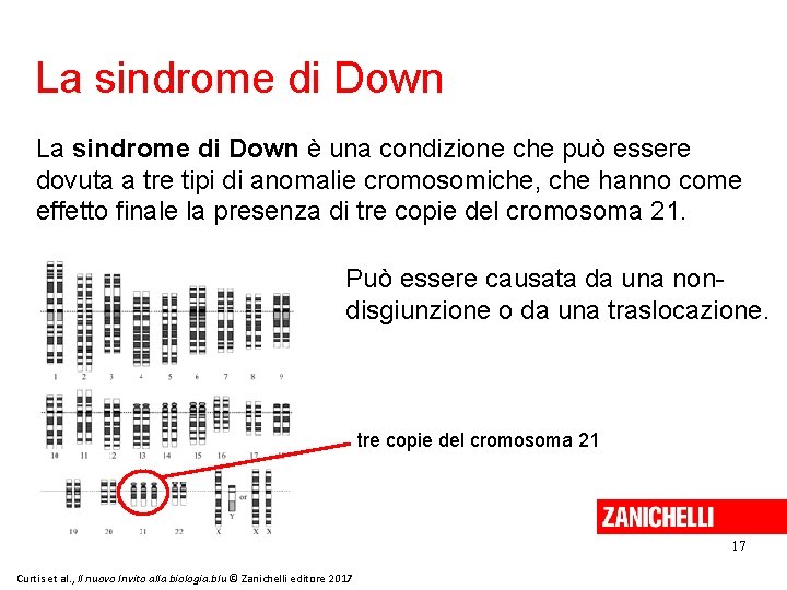 La sindrome di Down è una condizione che può essere dovuta a tre tipi