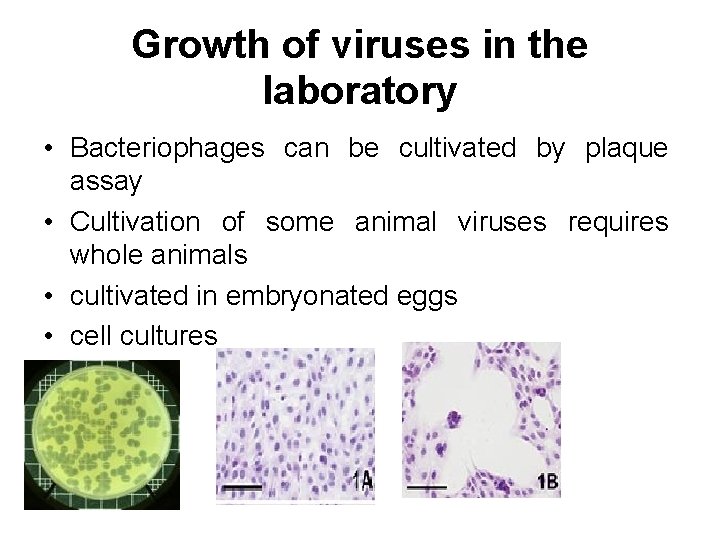 Growth of viruses in the laboratory • Bacteriophages can be cultivated by plaque assay