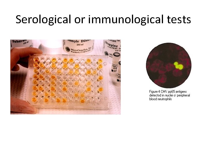 Serological or immunological tests 