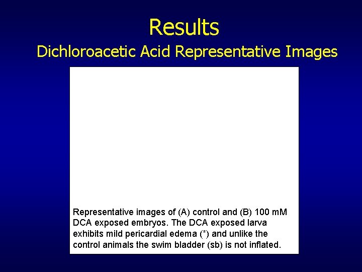 Results Dichloroacetic Acid Representative Images Representative images of (A) control and (B) 100 m.