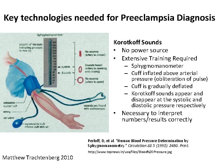 Key technologies needed for Preeclampsia Diagnosis Korotkoff Sounds • No power source • Extensive