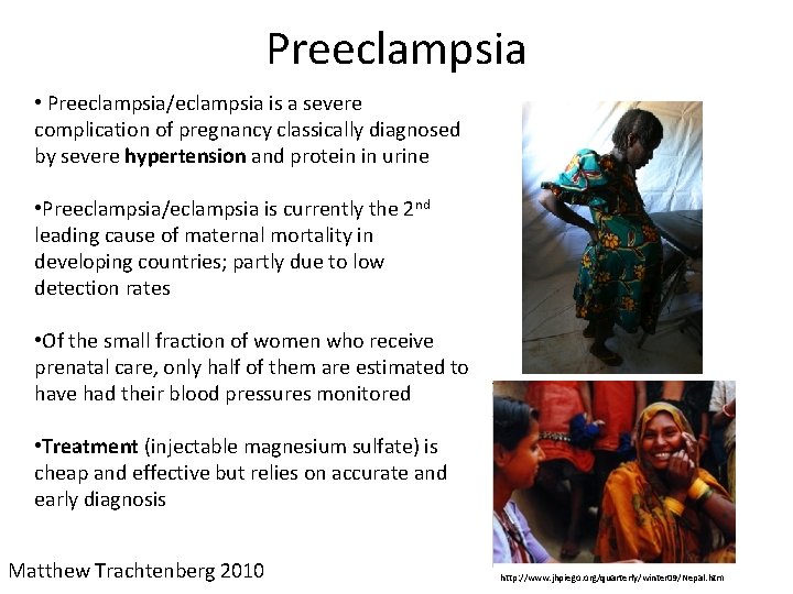 Preeclampsia • Preeclampsia/eclampsia is a severe complication of pregnancy classically diagnosed by severe hypertension