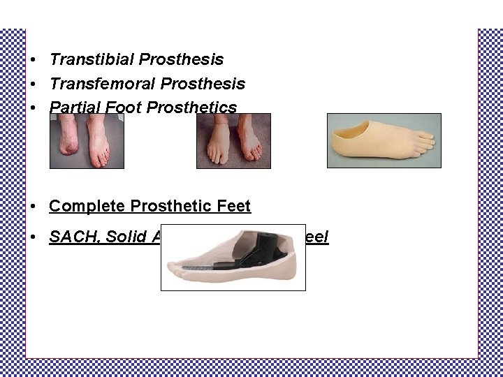  • Transtibial Prosthesis • Transfemoral Prosthesis • Partial Foot Prosthetics • Complete Prosthetic