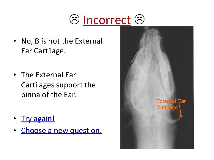  Incorrect • No, B is not the External Ear Cartilage. • The External