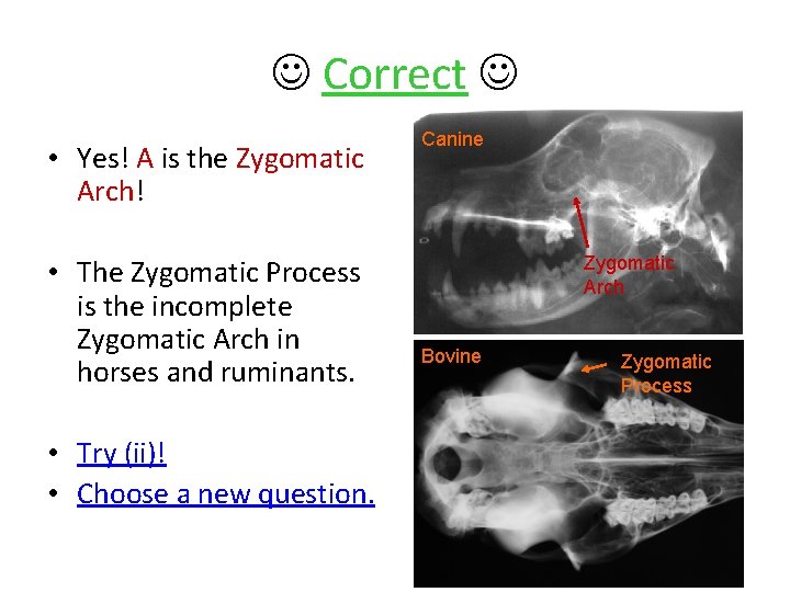  Correct • Yes! A is the Zygomatic Arch! • The Zygomatic Process is