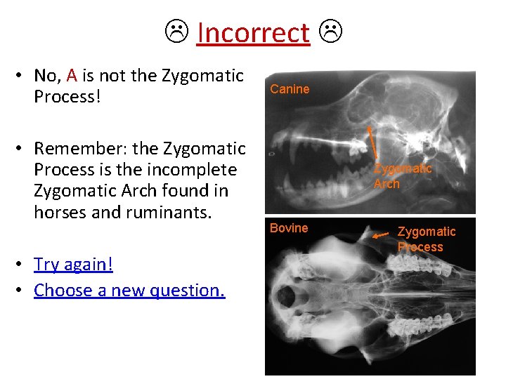  Incorrect • No, A is not the Zygomatic Process! • Remember: the Zygomatic