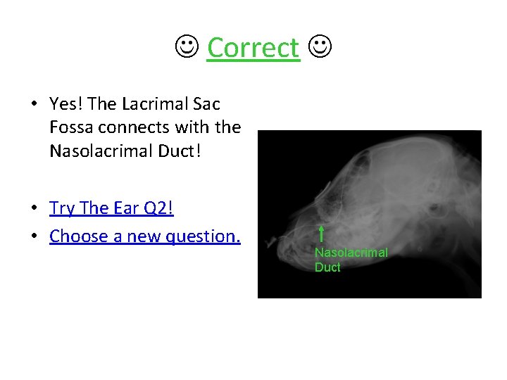  Correct • Yes! The Lacrimal Sac Fossa connects with the Nasolacrimal Duct! •