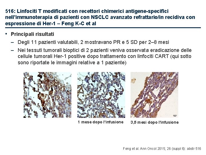 516: Linfociti T modificati con recettori chimerici antigene-specifici nell’immunoterapia di pazienti con NSCLC avanzato