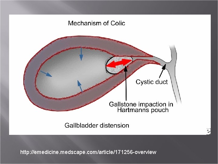 http: //emedicine. medscape. com/article/171256 -overview 