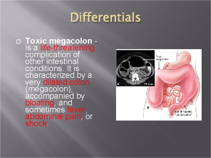 Differentials Toxic megacolon is a life-threatening complication of other intestinal conditions. It is characterized