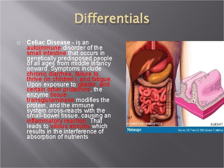 Differentials Celiac Disease - is an autoimmune disorder of the small intestine that occurs