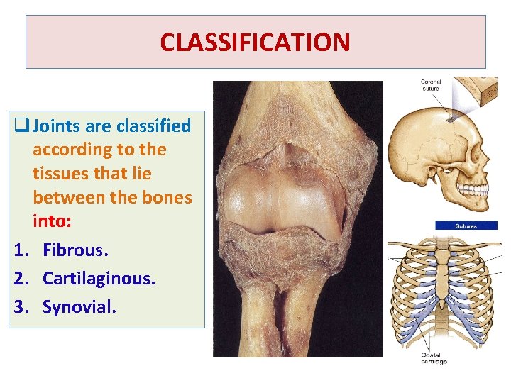 CLASSIFICATION q Joints are classified according to the tissues that lie between the bones