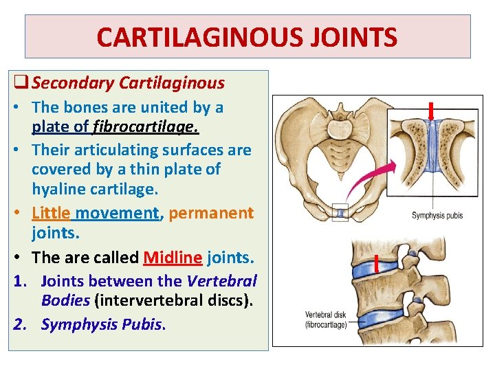 CARTILAGINOUS JOINTS q Secondary Cartilaginous • The bones are united by a plate of