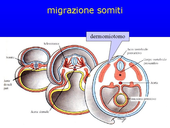 migrazione somiti dermomiotomo 