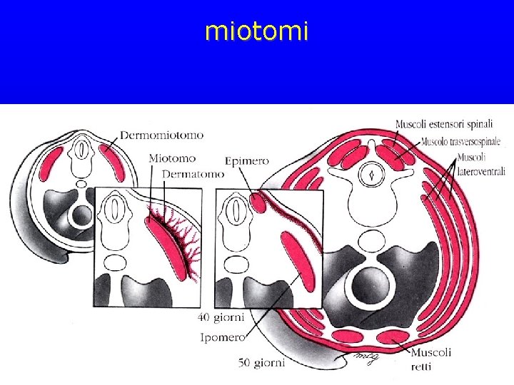 miotomi 