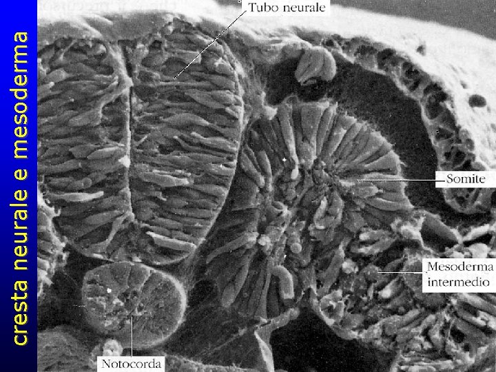 cresta neurale e mesoderma 