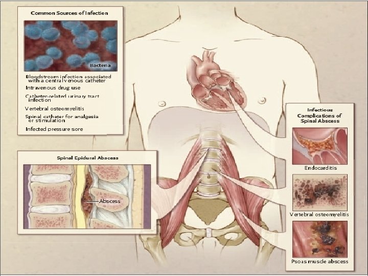  Cuadro de nejm 