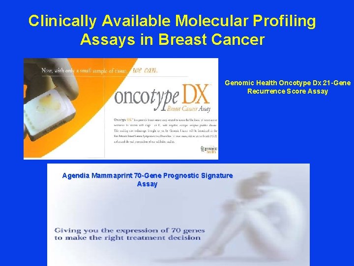Clinically Available Molecular Profiling Assays in Breast Cancer Genomic Health Oncotype Dx 21 -Gene