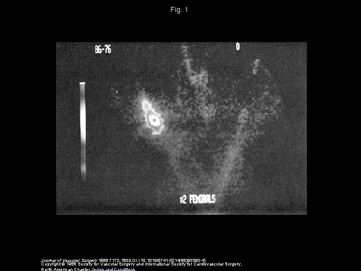 Fig. 1 Journal of Vascular Surgery 1988 7172 -180 DOI: (10. 1016/0741 -5214(88)90390 -4)