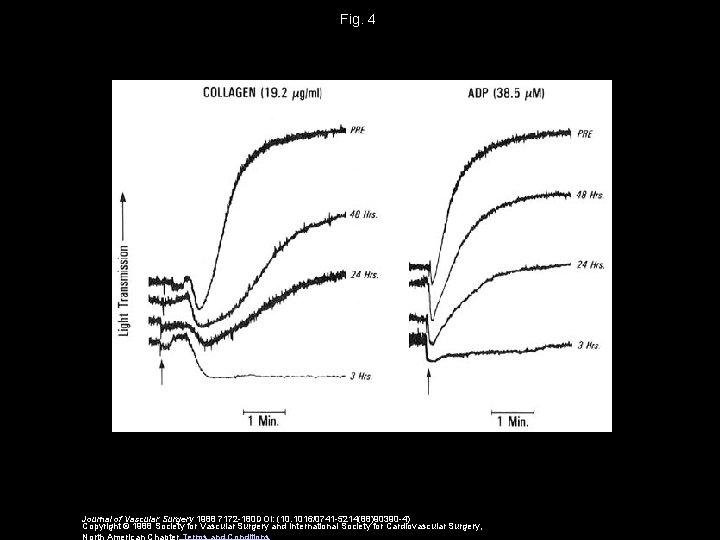 Fig. 4 Journal of Vascular Surgery 1988 7172 -180 DOI: (10. 1016/0741 -5214(88)90390 -4)